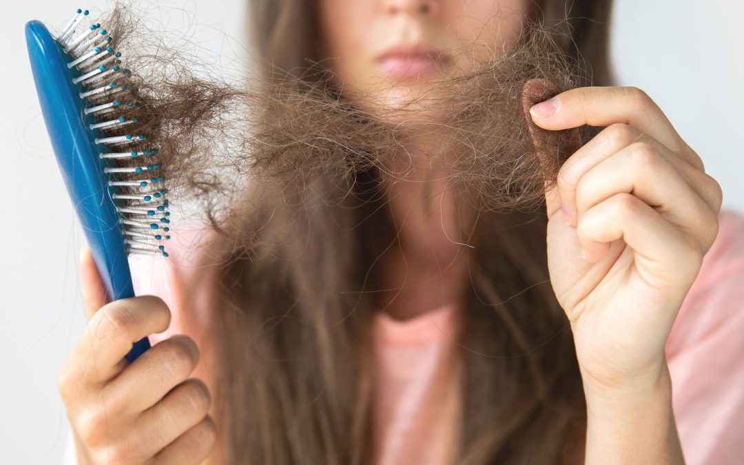 What Causes Hair Loss and What Can You Do About It?